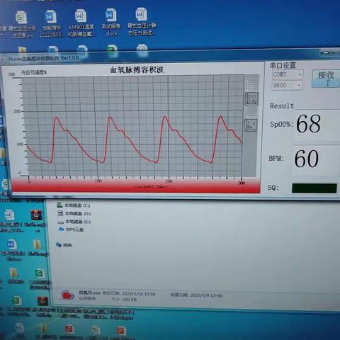 70-30低血氧试验……