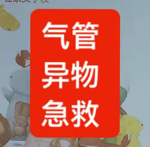 气管异物急救    考试实操