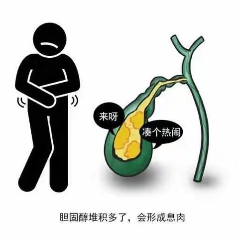 胆囊息肉会不会癌变？主要看一个指标，超过了就应该尽早手术