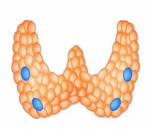 骨骼变形？原发性甲状旁腺功能亢进是什么？