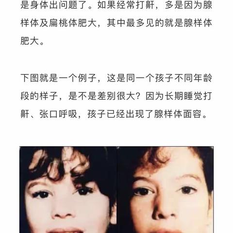 孩子常常打鼾，长大居然可能会变丑？