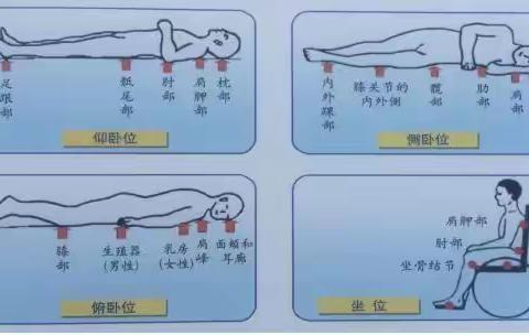 外一科患教会—压疮的预防和护理49