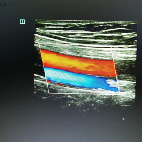2021超声科健康宣教 ——就诊必读
