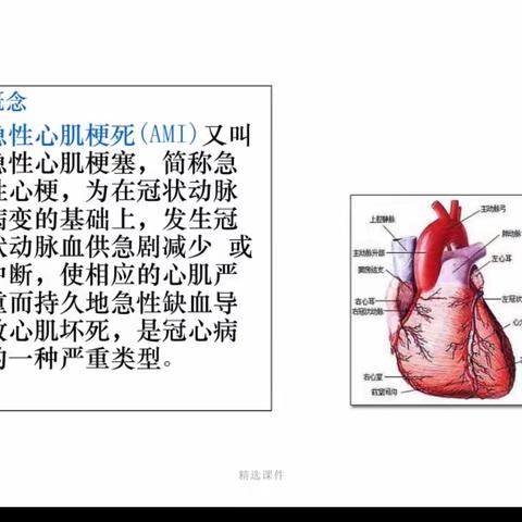 关爱心脏 预防心肌梗死