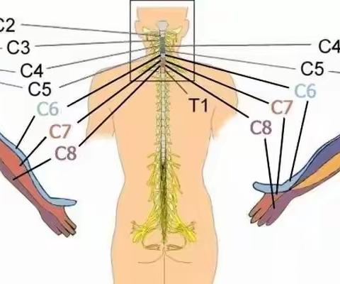 对号入座！颈椎病导致不同手指麻木，提示颈神经受压！