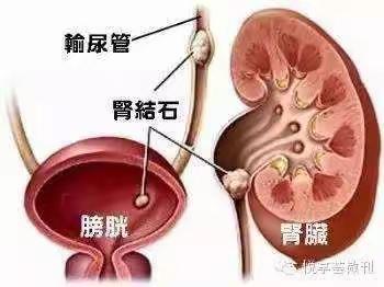 医护患座谈宣教     构建和谐连心桥