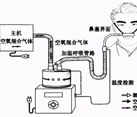 🐚 HFNC的临床实际应用要点