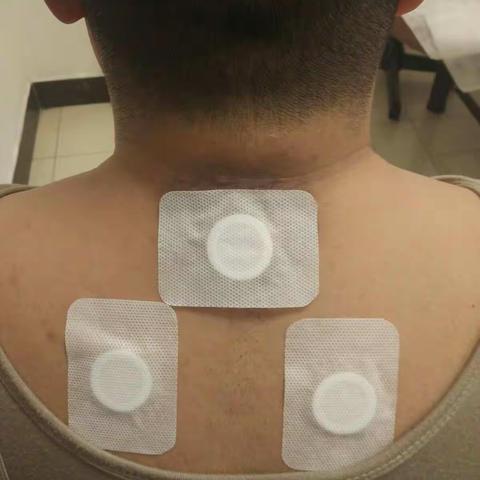 吉大一院中医科 “三九贴”开始预约啦