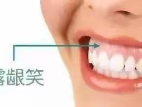 卓维雅口腔早报分享《小心牙周炎整掉你的牙齿》！