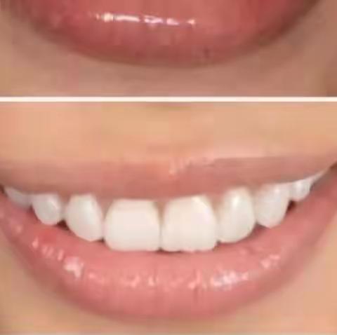 卓维雅口腔早报分享