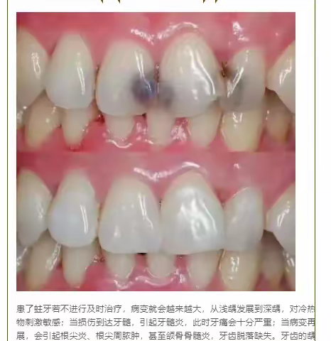 卓维雅口腔早报分享