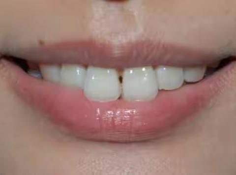 卓维雅口腔早报分享