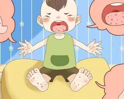 香格里拉伟才幼儿园----【育儿保健】夏季儿童各种传染病