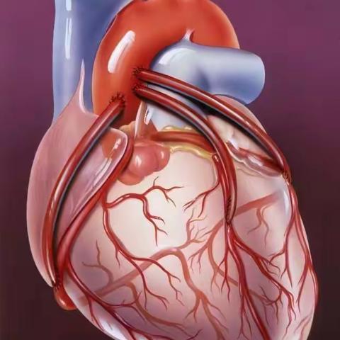 冠心病案例分享