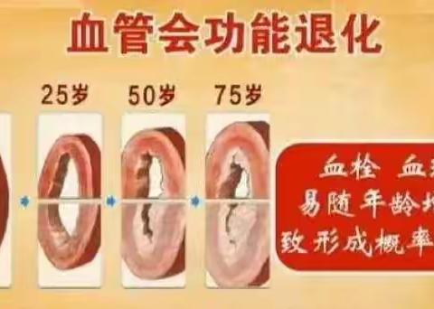 保持血管年轻，别做这5件事，多学这5招！
