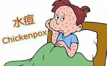 水痘来袭！怎样不做“痘”宝宝？