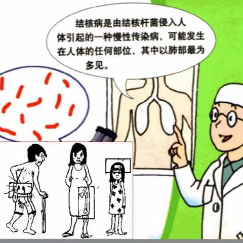 结核病防治知识的宣传——郑韩路小学四年级学习肺结核知识