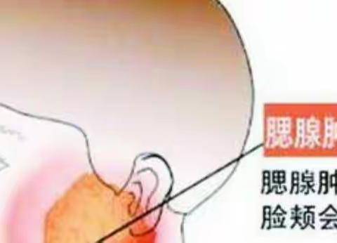 阳光宝贝幼儿园春季疾病预防保健知识