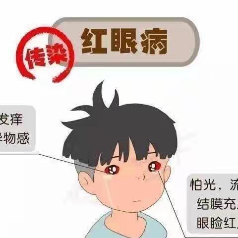 “爱护眼睛，预防红眼病”——边阳镇中心幼儿园预防红眼病健康知识宣传