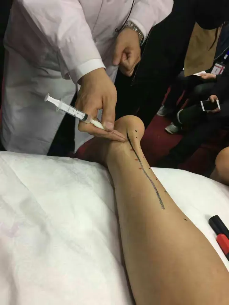 北京世针联中医微创水针刀筋骨三针法初级班今天在湖南长沙圆满结束