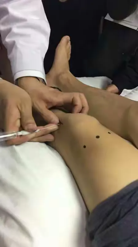 北京世针联中医微创水针刀筋骨三针法初级班今天在湖南长沙圆满结束