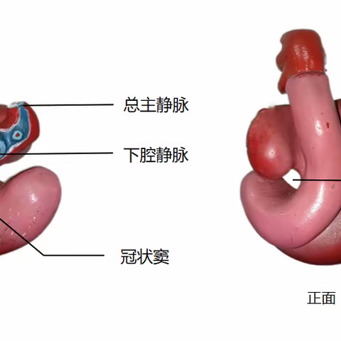 心血管A2-3