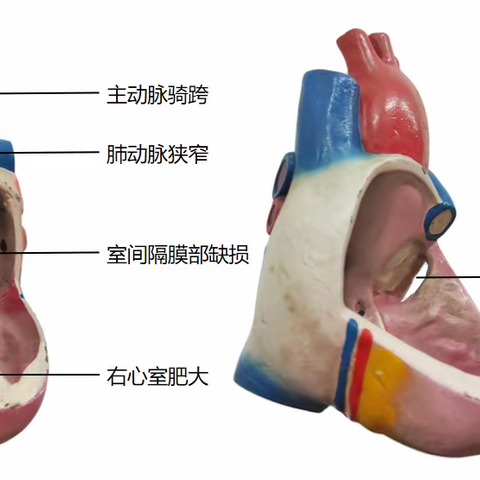 心血管先天畸形C1-4