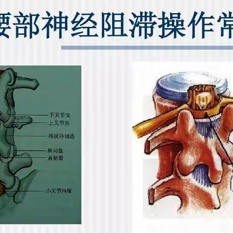 腰部神经阻滞