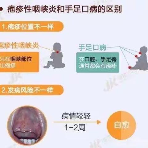 【春夏季传染病预防】———仁风镇王圈幼儿园！