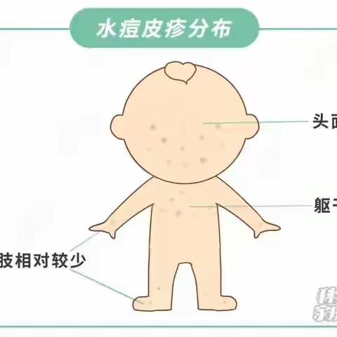 如何预防水痘