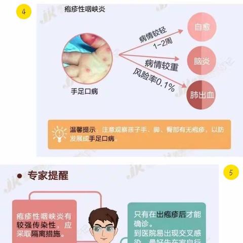 高新区第四十三幼儿园【家园共育】预防疱疹性咽峡炎告家长书。