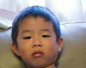 南房小学秋冬季传染病预防宣传之腮腺炎