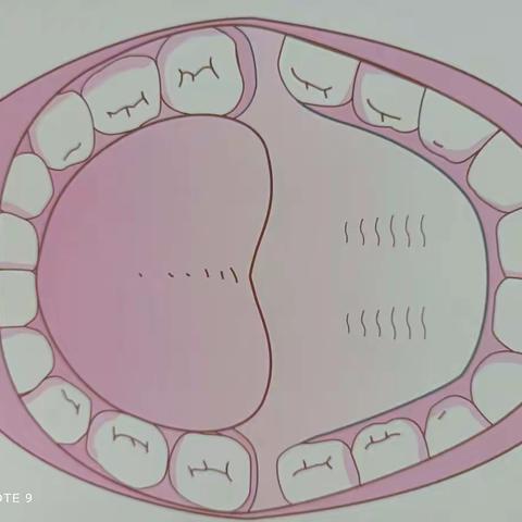 健康活动课～我们的牙齿🦷