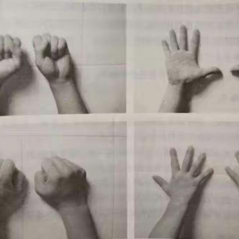 驻马店市残疾人康复中心【停课不停训，康复不延期】——锻炼脑瘫儿童手部的十个运动操