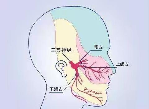 三叉神经痛~不可言喻的痛