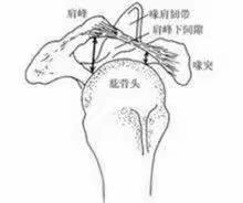 关节镜下肩袖修补术，精准医疗效果好