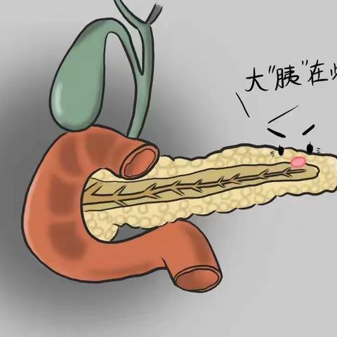 急性胰腺炎