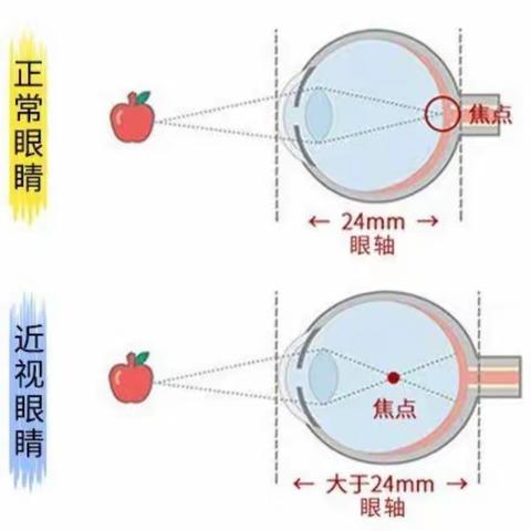 爱眼护眼 “睛”彩童年