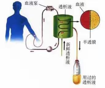 肾脏疾病的健康宣教                          （康乐县人民医院血液透析中心）