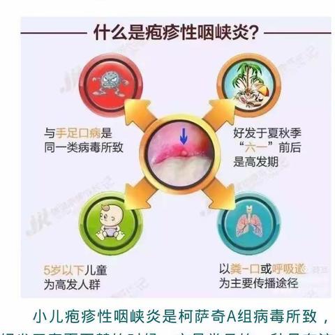 【家园共育】预防疱疹性咽峡炎