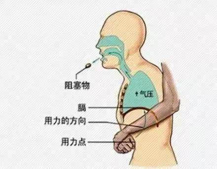 关爱生命  救在身边