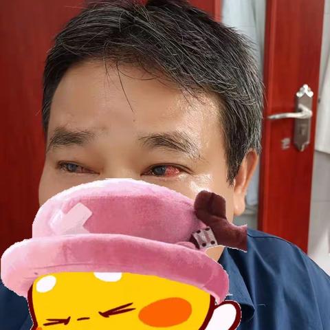 苍梧县京南镇卫生院中医科针对“红眼病”放血疗法治疗效果非常明显