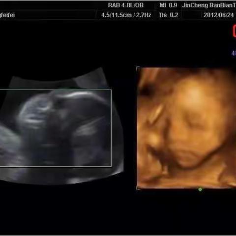 开封市人民医院土柏岗院区    彩超、心电图室