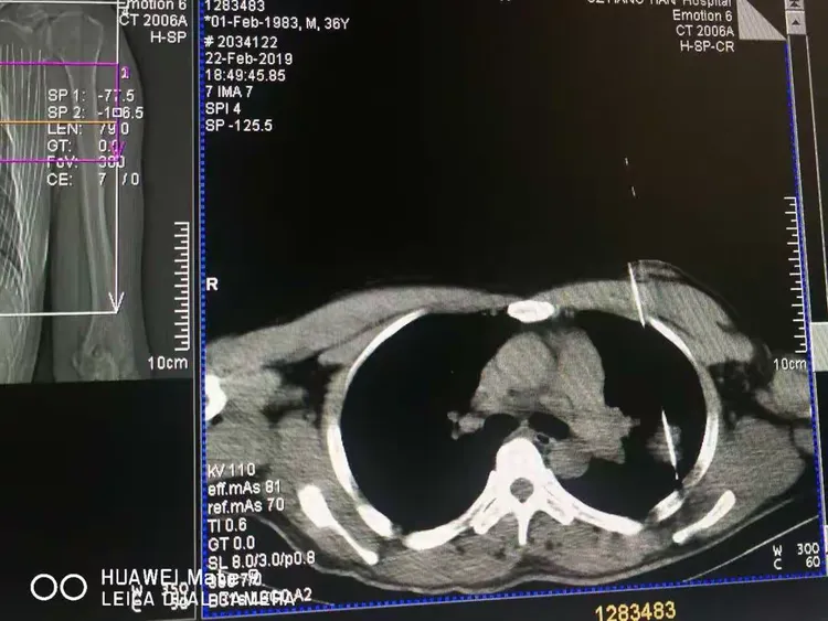 包含航天总医院黄牛排队挂号CT加急办理入院+包成功的词条
