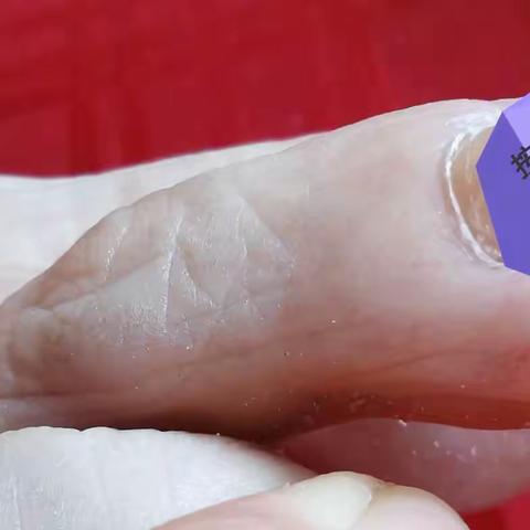 我目前是焦点人物，身体健康是我的重点，保证睡眠和监护三高是重中之重