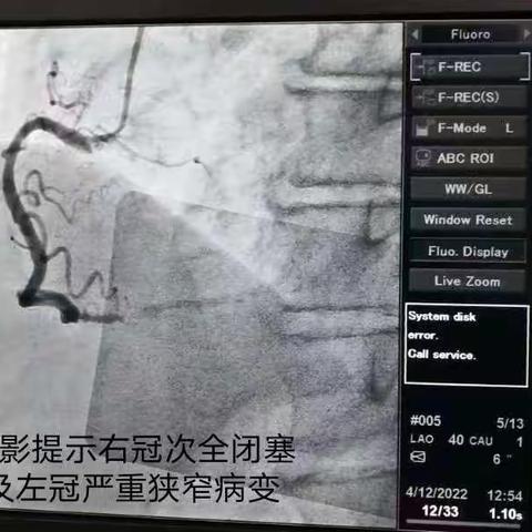 生死竞赛，接力生命