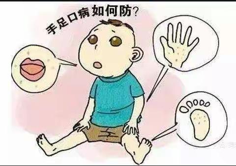 手足口病的预防