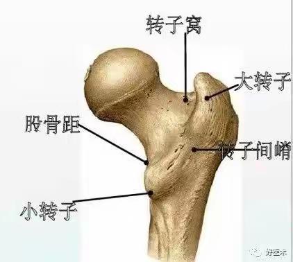 一篇文章带你认识股骨转子间骨折