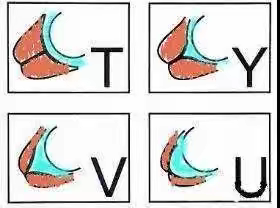 宫颈机能不全1问与答1