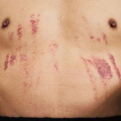 伏天了，小心中暑，或霍乱